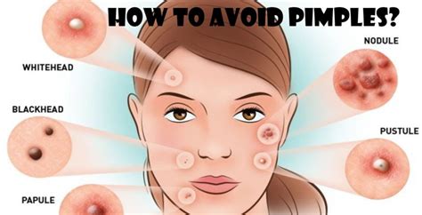 Is it normal for a pimple to bleed. Things To Know About Is it normal for a pimple to bleed. 